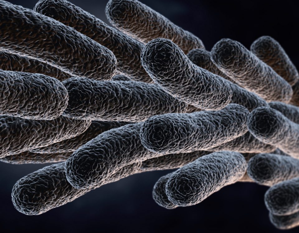 Prevenzione e controllo legionella