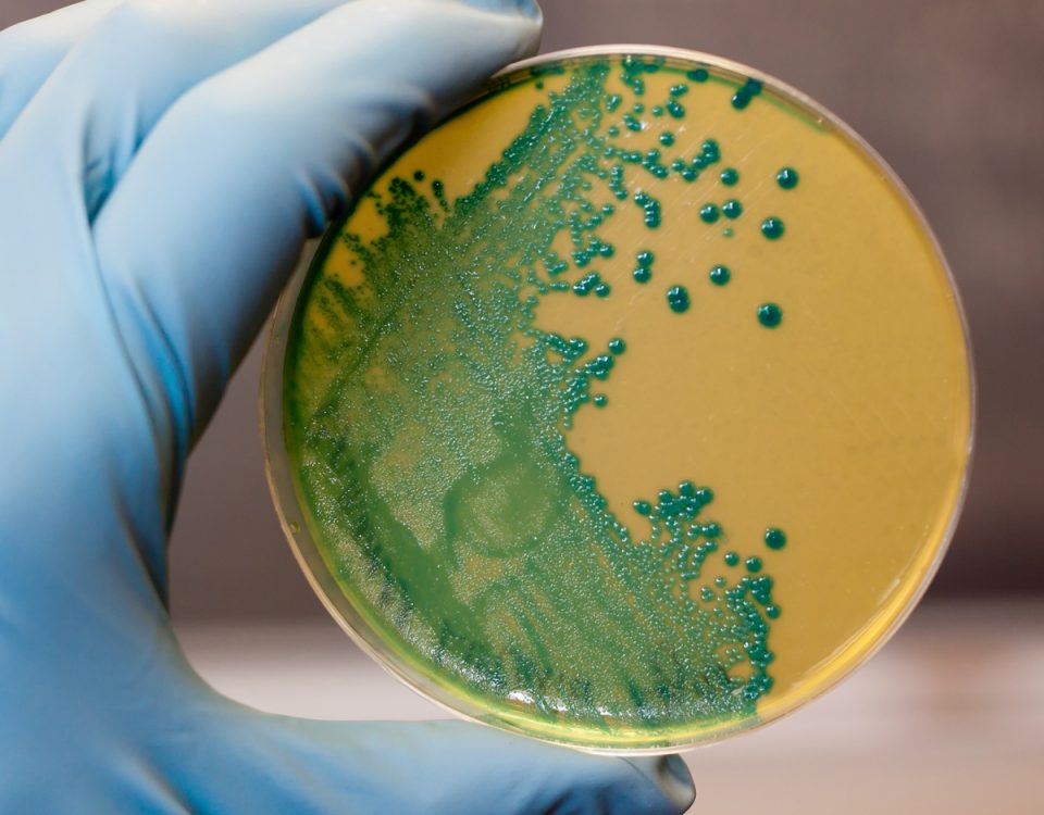 Prevenzione e cotrollo legionella